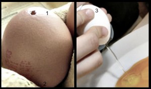 oeufs
