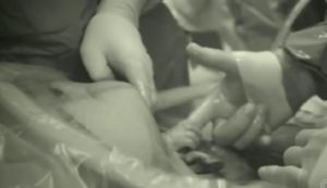 cesarienne bebe donne main medecin