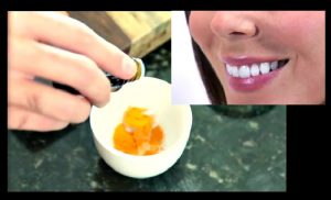 astuce dent blanche huile coco
