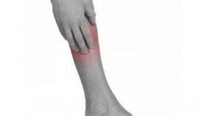 astuce sante symptome thrombose veineuse jambe chaleur